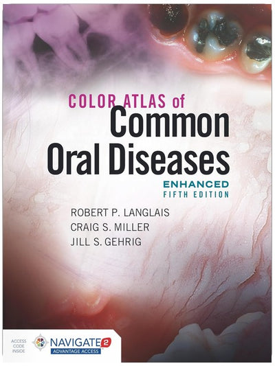 Color Atlas of Common Oral Diseases, Enhanced Edition